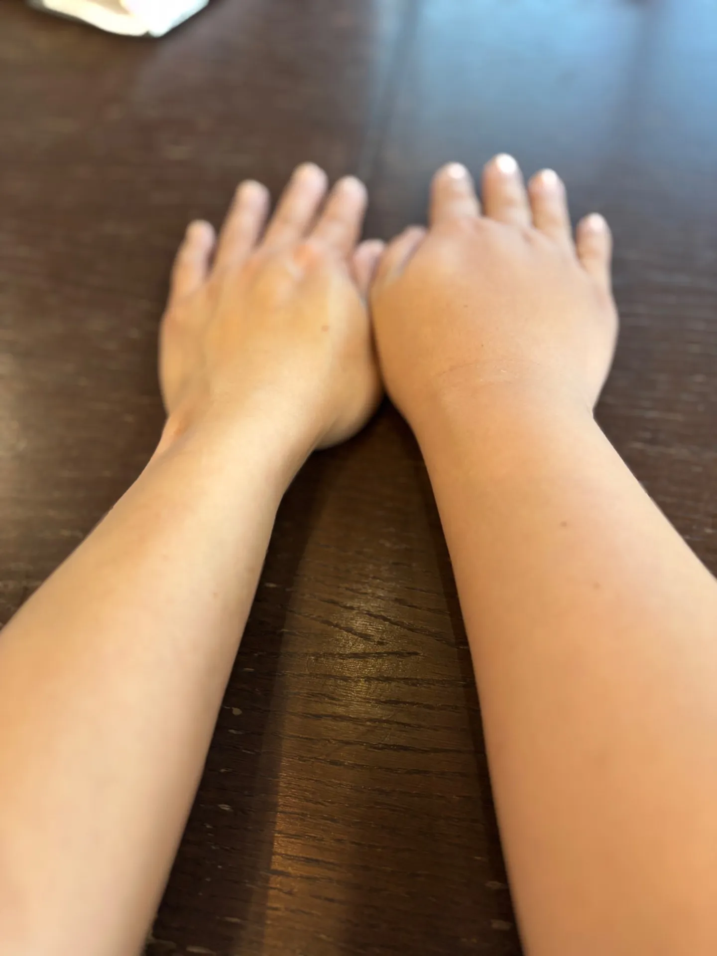 リンパ浮腫になって感じたこと